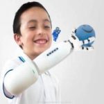 Come può un bambino che ha perso un braccio ricominciare a giocare?